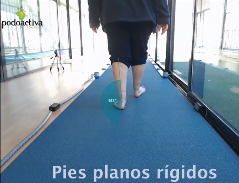 pies_planos_rigidos