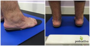 Pie zambo Podoactiva