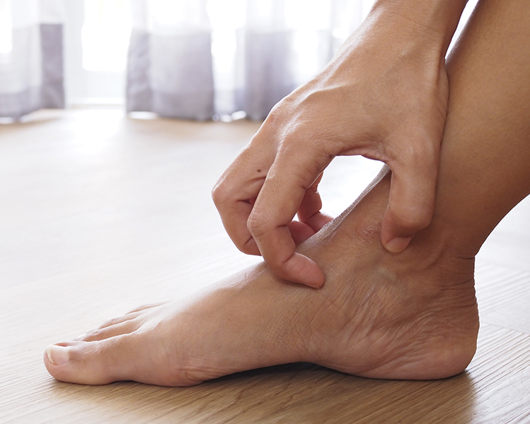 Hand scratching the instep of a foot for athlete's foot