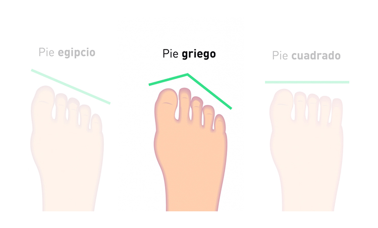 Infografía de tipos de pies destacando el griego