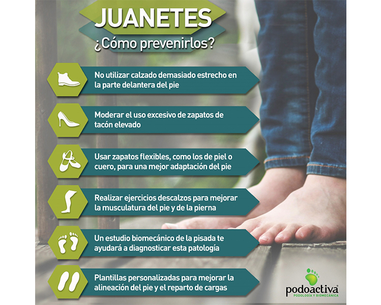 Infografía de juanetes propia de Podoactiva