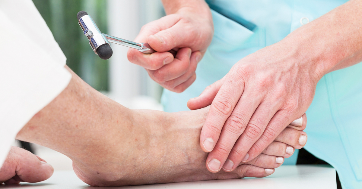 Pie diabético. Consejos y tratamientos para prevenir úlceras en los pies