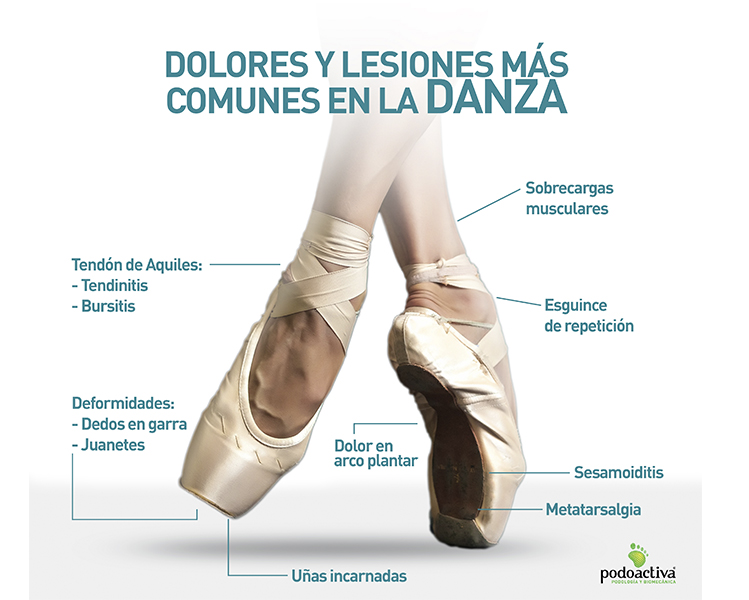 Infografía de los dolores y lesiones más comunes en la danza