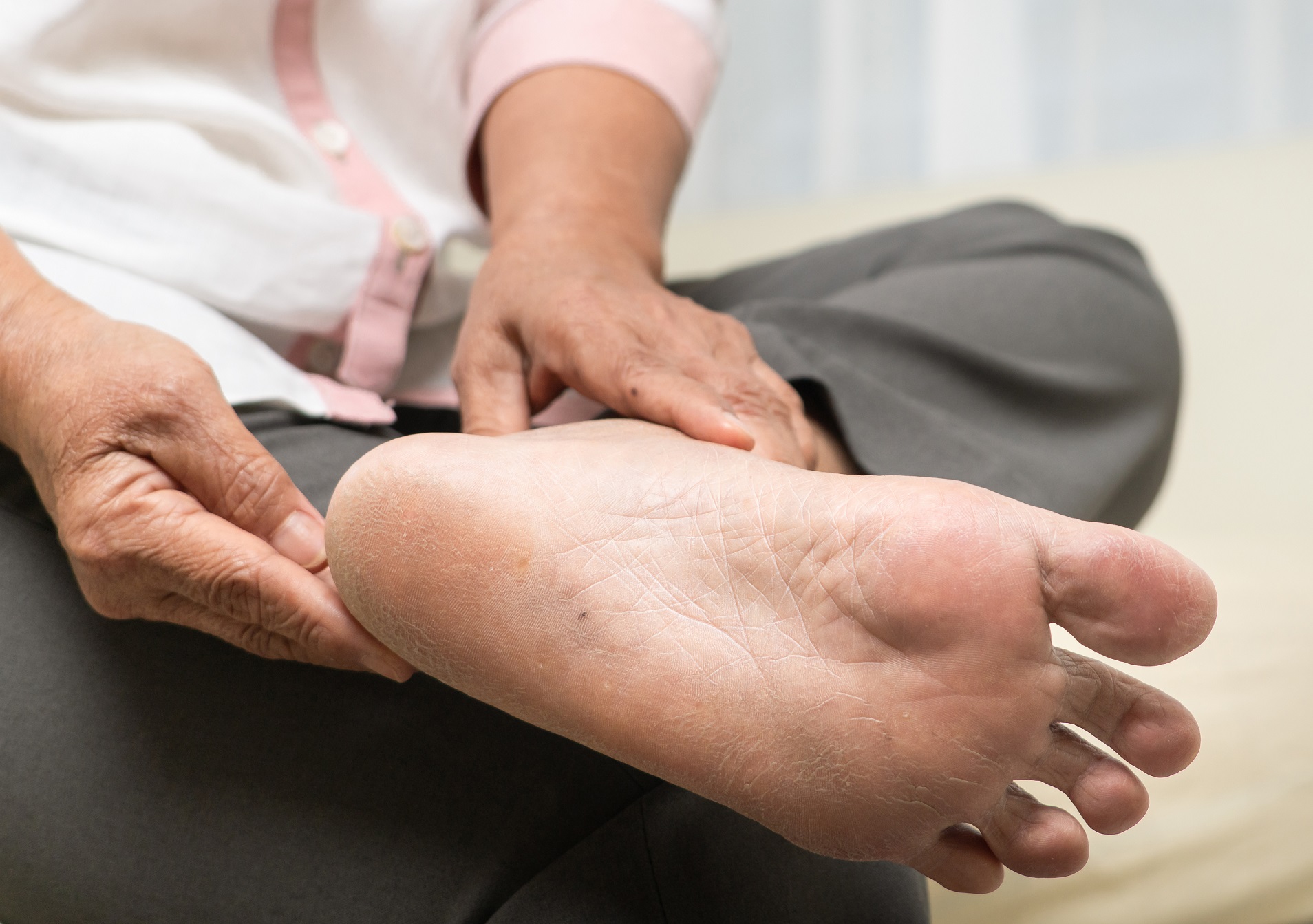 juntos Mecánica transacción Artrosis en los pies. Causas, síntomas y consejos para esta enfermedad