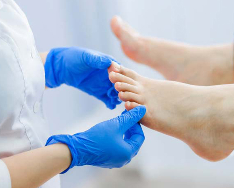 Manos de médico examinando unos pies de un paciente con cáncer