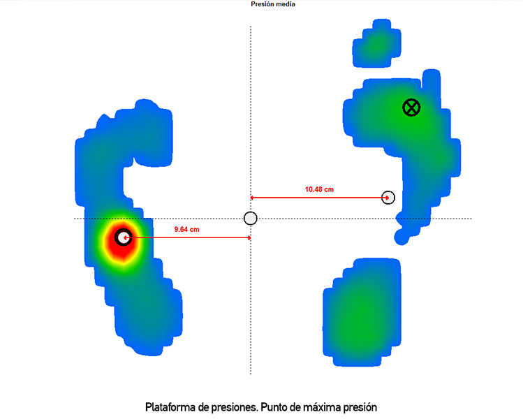 analisis de huella plantar de podoactiva