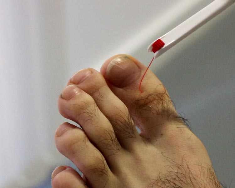 prueba para pie diabético en el dedo gordo del pie