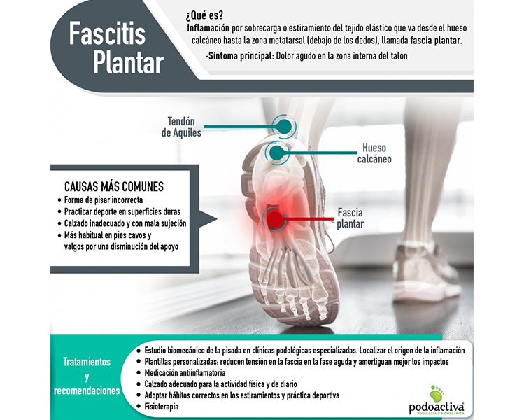 Infografía sobre fascitis plantar de Podoactiva