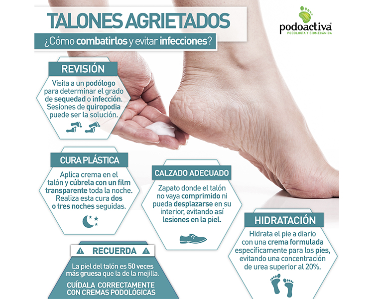 Infografía de Podoactiva sobre talones agrietados