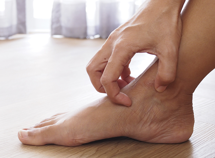 Pie de atleta. Tipos de infección y consejos para prevenirlo