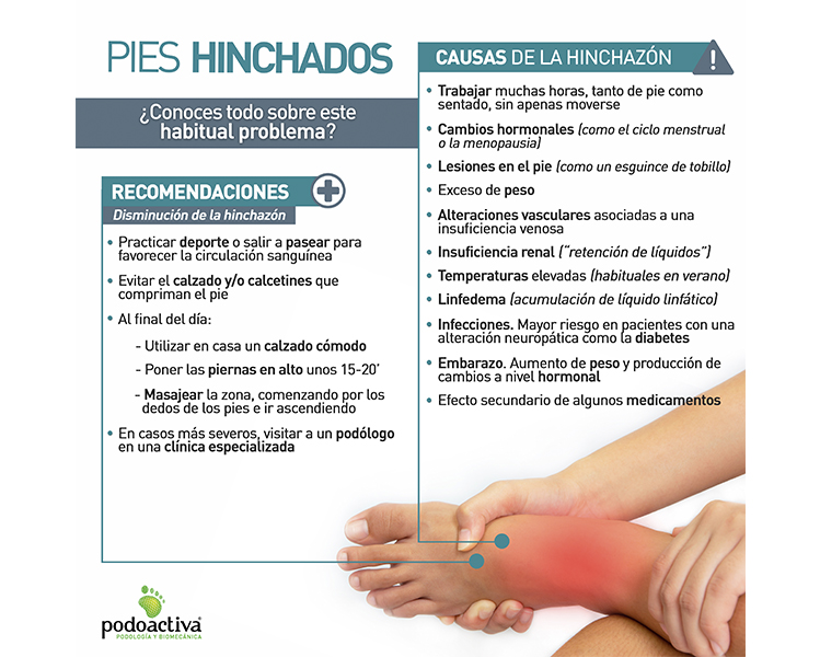 Infografía sobre pies hinchados