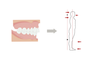 Clase II Molar