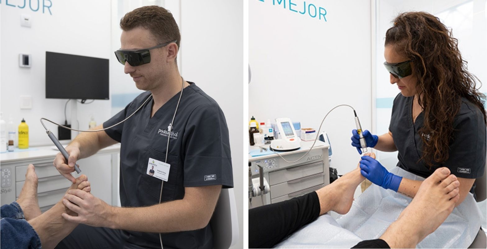 Tratamiento de hongos en las uñas con láser