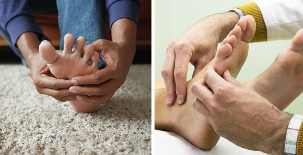 Dolor en la planta del pie - fascitis plantar