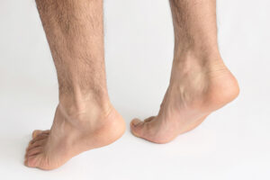 tendinopatia aquilea en el tendon de aqulies