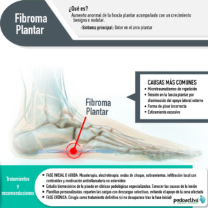 fibroma plantar