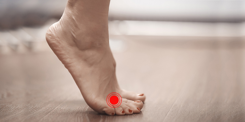 Los peligros para tu salud de llevar zapatos de tacón 5 Moncloa zapatos de tacón