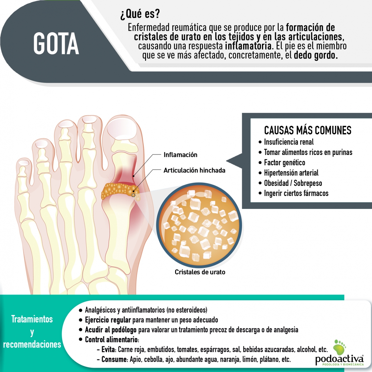 guta reumatica)