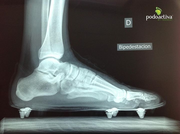 Calzar habitualmente botas de fútbol sala puede afectar a los pies de los  niños