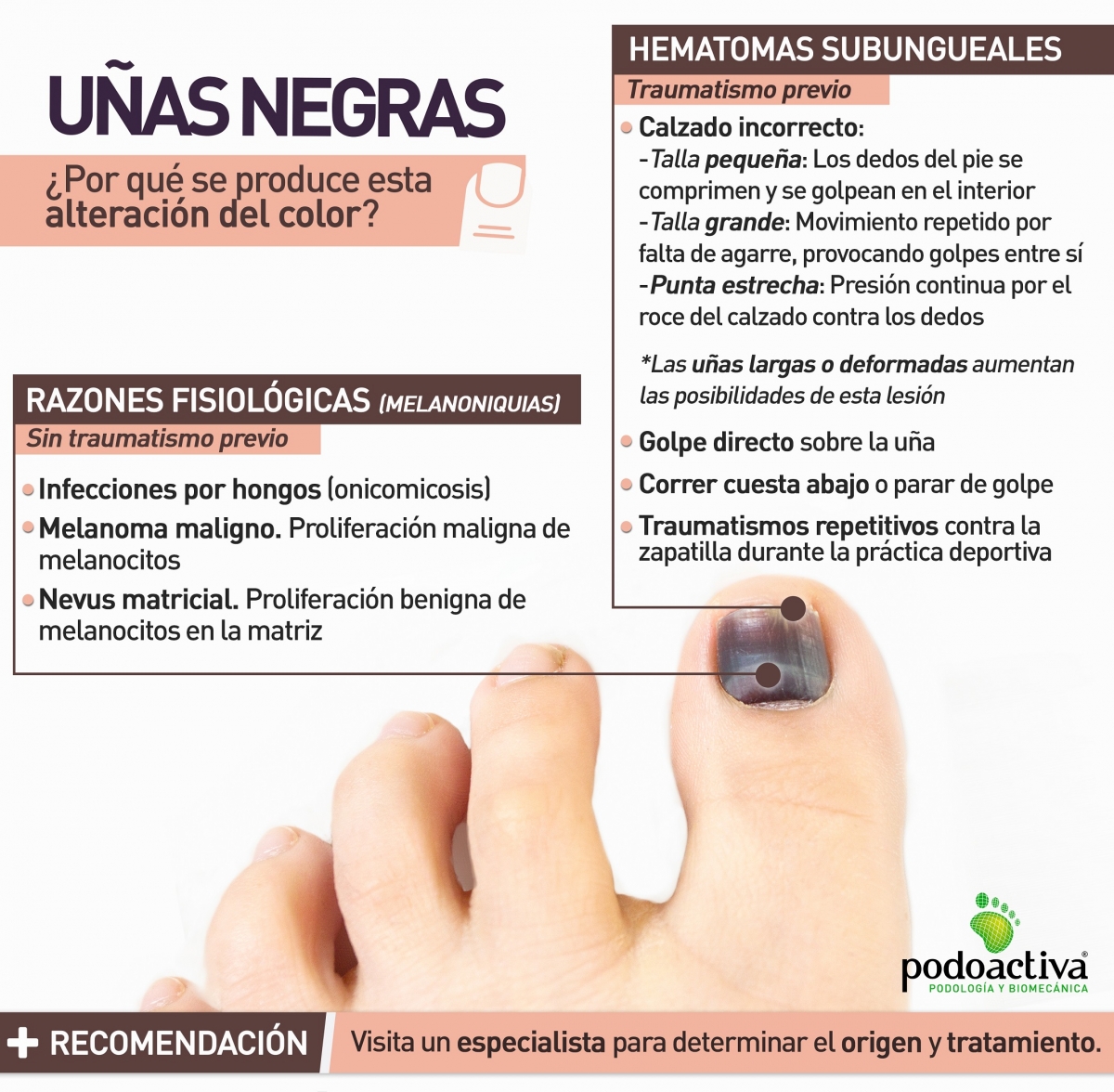 Aprender acerca 37+ imagen como quitar lo negro de las uñas