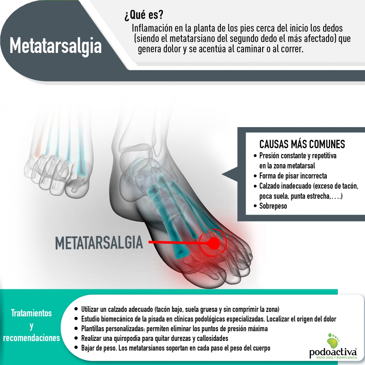 Papúa Nueva Guinea Apoyarse prometedor Metatarsalgia: qué es y cómo se origina