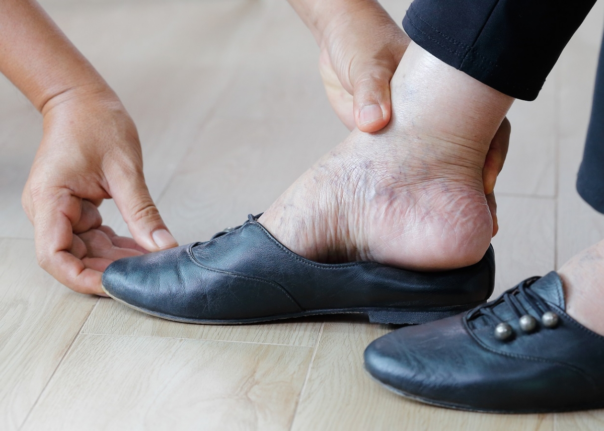cuidado de los pies en pacientes con alzheimer