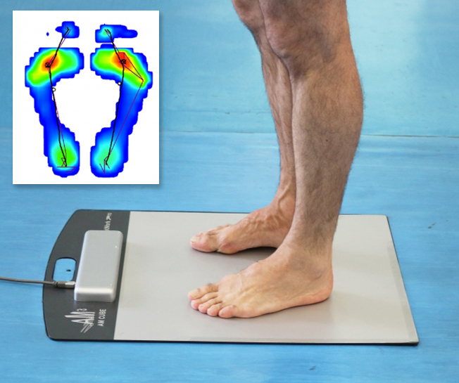 At Podoactiva we carry out this analysis of the footprint of the foot, in static and dynamic.