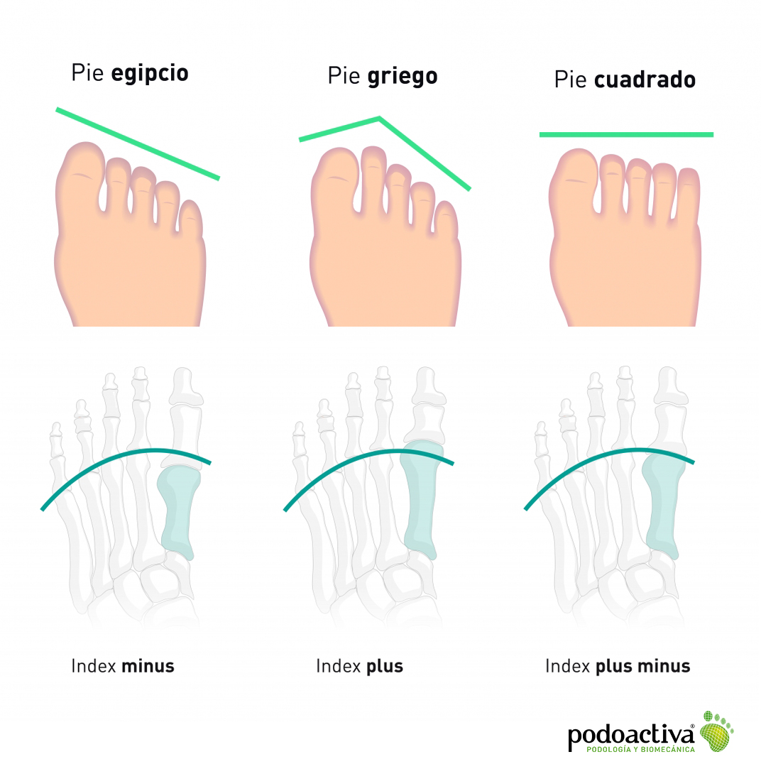 Tipos de pie dependiendo de la forma de los dedos