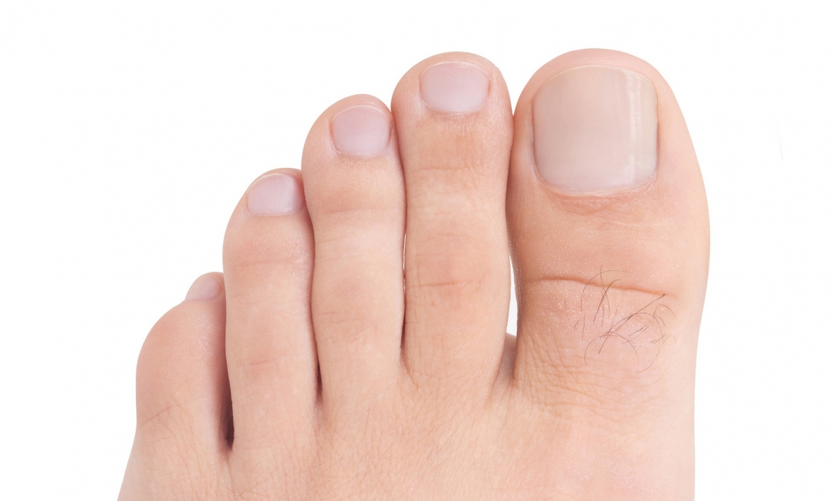 Consejos para cortar las uñas de los pies  Podoactiva Líderes en Podología